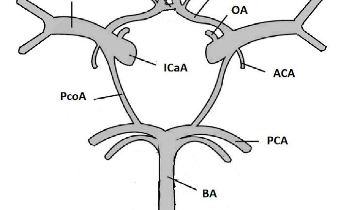 circle of willis