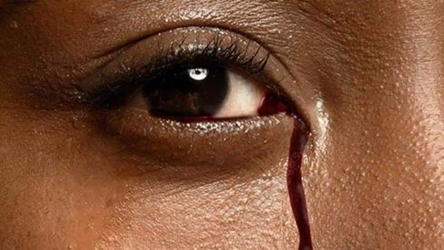 vicarious mesntruation