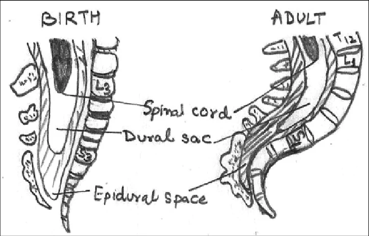 spinal cord level in neonate and adults