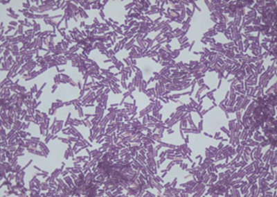 bacillus clausii probiotic strains