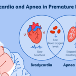 Apnoea of prematurity