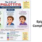 3 d of epiglottitis