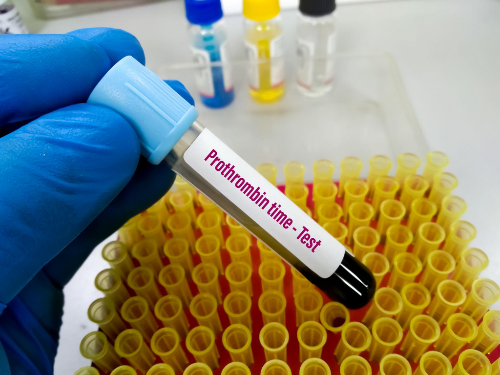 Prothombin time and inr